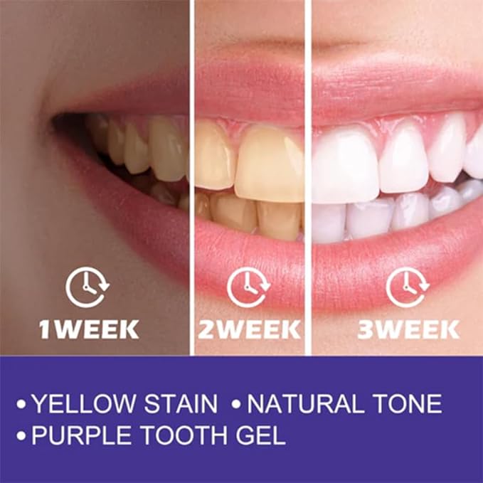 Purple Whitening Toothpaste / معجون تبييض الأسنان باللون الأرجواني