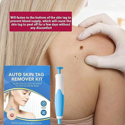 Acrochordon Skin Remover Kit / مجموعة إزالة الجلد من أكروكوردون