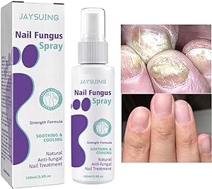 Nail Fungus Spray / رذاذ فطريات الأظافر