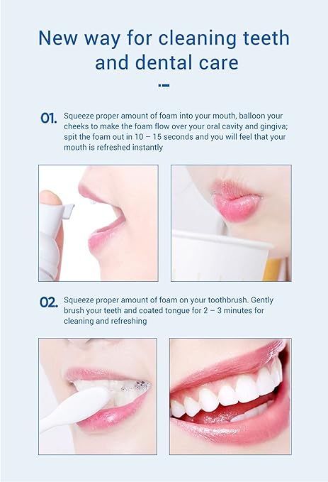 Teeth Whitening Mousse / موس تبييض الأسنان