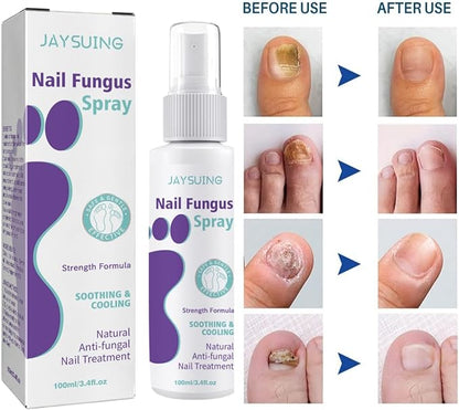 Nail Fungus Spray / رذاذ فطريات الأظافر