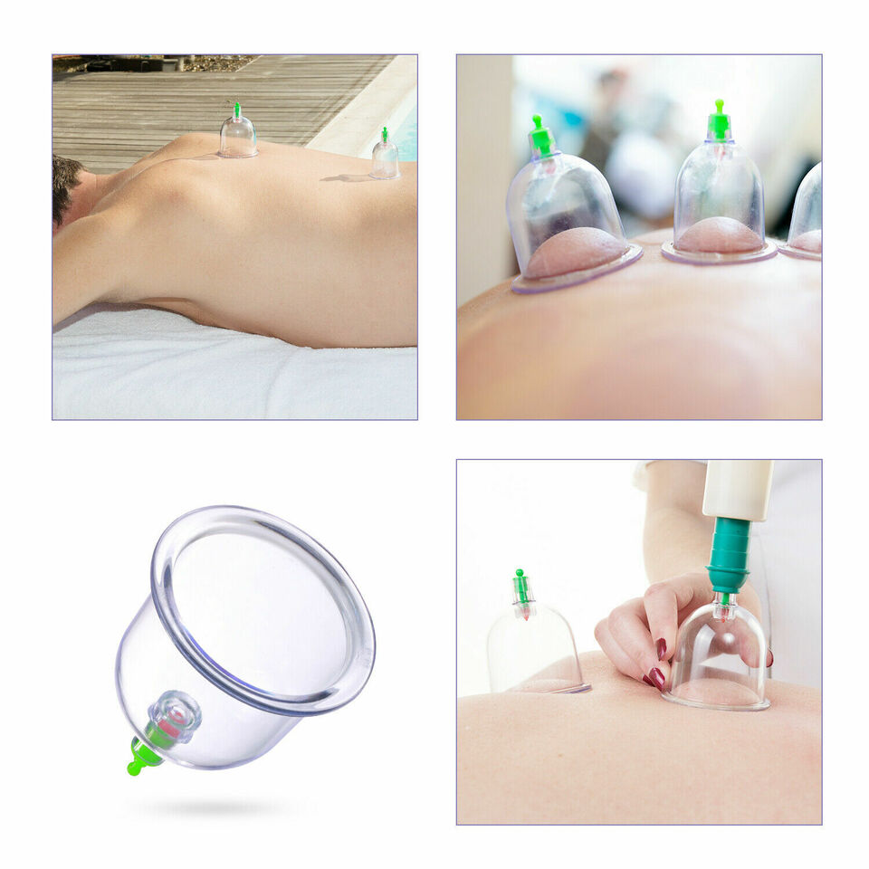 Body Cupping Healthy Set / مجموعة صحية لحجامة الجسم