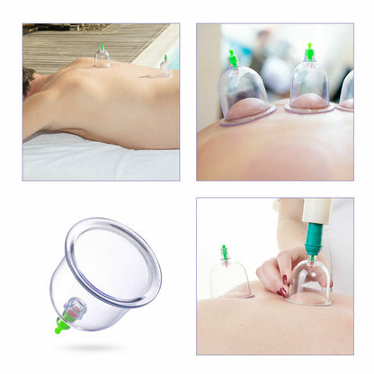 Body Cupping Healthy Set / مجموعة صحية لحجامة الجسم